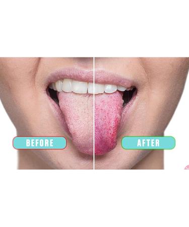 Verdant Touch Copper Tongue Scraper Tool with Case | Effective Tongue Cleaning Brush for Bad Breath Reduction - Buy Online on GoSupps.com