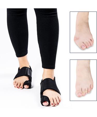 ALINZO Copper Infused Bunion Corrector for Hallux Valgus Relief - Toe Straightener for Women & Men - Black (1 Pair) - Buy Online on GoSupps.com