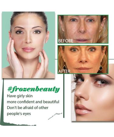 siduytin Women Face Wrinkle Fine Line Removal Ladies Hydrating Firming Tightening for Essence Anti-age Beauty Supplies - Buy Online on GoSupps.com