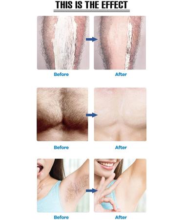 Crystal Hair Eraser for Women Legs - Painless Hair Removal Tool - Washable Nano Hair Remover - Smooth Skin Effect - Black - Buy Online on GoSupps.com