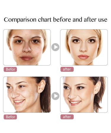 7 Colors Light Therapy Facial Mask for Home Use | Illuminate Your Skin - Buy Online on GoSupps.com