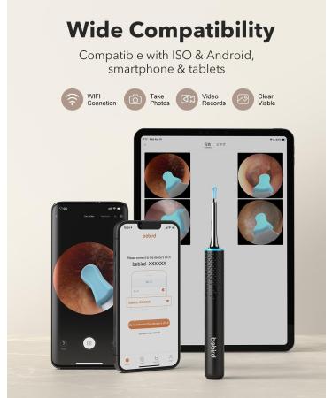 Bebird M9 Ear Wax Removal Tool - Wireless Ear Cleaner with Camera & Light | Visual Otoscope for Family | Photos & Videos | 10 Scoops & Attachments - Buy Online on GoSupps.com