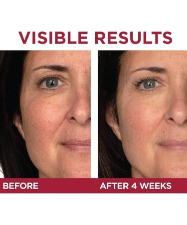 L'Oreal Paris Revitalift Triple Power LZR Anti Aging Day & Night Face Cream With Pro Retinol Vitamin C + Hyaluronic Acid Anti Wrinkle Moisturizer Skin Care Kit 2 Count - Buy Online on GoSupps.com