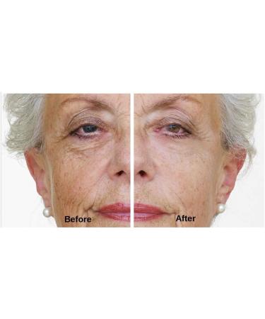 DERMAWORKS Instant Face Lift Serum for Dark Circles, Puffy Eyes & Wrinkles - Buy Online on GoSupps.com