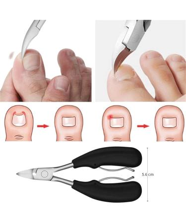 CHJHJKG Nail Clippers (Beauty) Toe Nail Clippers Remove Dead Skin Nail Correction Nippers Ingrown Toenail Cuticle Scissor Edge Cutter Thick Pedicure Care Tool(Blue) - Buy Online on GoSupps.com