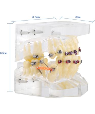 Buy Creotime Dental Tooth Model for Orthodontic Malocclusion Study - PVC & Harz Wire Chain - International Shipping Available! - Buy Online on GoSupps.com