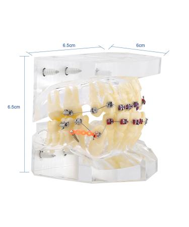Tooth Model for Orthodontic Treatment - Wire Chain & Brackets | Dental Study Model for Precise Diagnosis & Planning - Buy Online on GoSupps.com