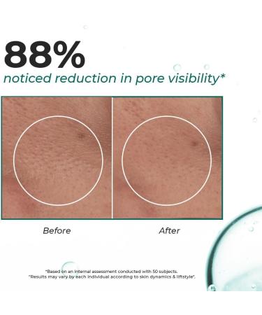 Conscious Chemist Blackhead Melting Water Gentle Pore Treatment with Succinic Glycolic Acid & CICA Exosome Unclogs Pores Dissolves Blackheads & Smoothens Skin Toner 50 ml (Pack of 1) Clear - Buy Online on GoSupps.com