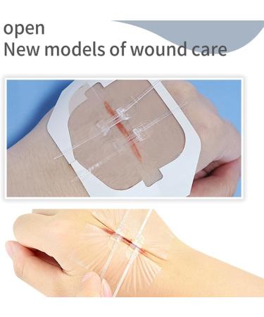 Sutures Adhesive Bandages 2 PCS - Surgical Laceration Repair Quick Clot Emergency Wound Closure Device 2.8 Inch - Buy Online on GoSupps.com