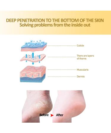 3 Pack Cracked Skin Repair Cream Anti Chapping Cream for Winter Skin Winter Cracked Hand & Foot Cream Dry Foot Ointment Cream Heel Cracks - Buy Online on GoSupps.com