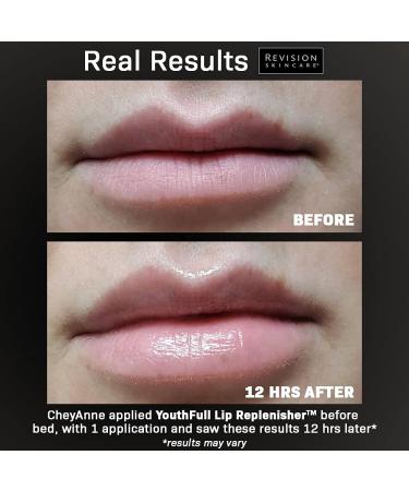 Revision Skincare YouthFull Lip Replenisher 0.33 oz - The Definitive Solution for Youthful Lips - Buy Online on GoSupps.com