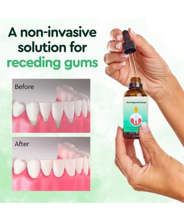 Gum Regrowth Drops | Natural Gum Restoration & Rejuvenation | Oral Care Mouthwash 30ml (2PCs) - Enhance Gum Health - Buy Online on GoSupps.com