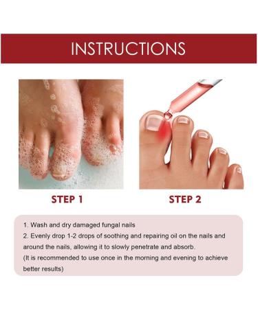 German Toenailcare Paronychia & Bunion Relief Oil for Thick, Discolored Nails - 1Pcs - Buy Online on GoSupps.com