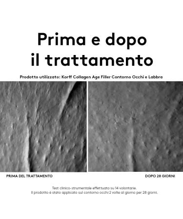 Korff Collagen Age Filler Eye & Lip Contour - Marine Collagen & Vitamin PP | 15ml - Anti-Aging Skincare - Buy Online on GoSupps.com