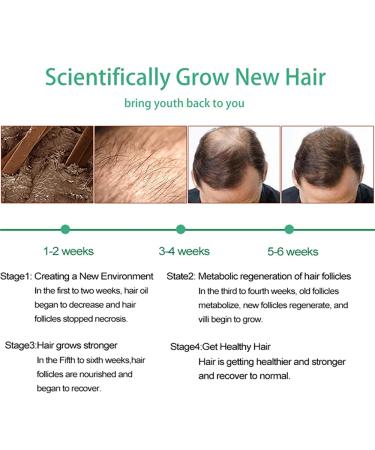 Hair Growth Serum - Fast Hair Growth & Thickening Treatment for Men & Women | 30ml Hair Care Solution - Buy Online on GoSupps.com