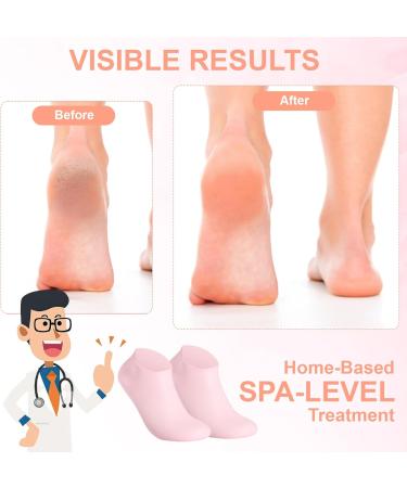 Asilumi 3 Pairs Silicone Socks for Dry Cracked Feet Women Silicone Moisturizing Socks Foot Spa Pedicure Gel Socks for Repairing Dry Feet Foot Care Cracked Heels and Softening Rough Skin - Buy Online on GoSupps.com