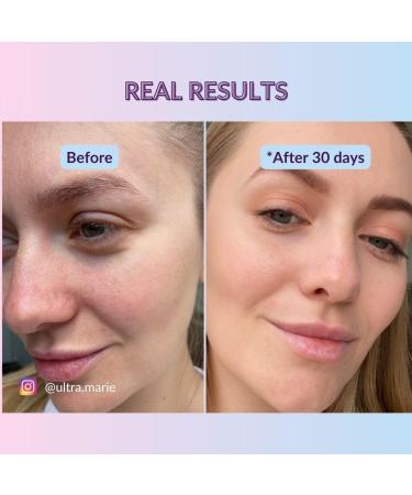 Hyaluronic Acid Serum with ORGANIC Aloe Vera - NATURAL COSMETICS VEGAN - Highly Concentrated - 30ml - Intensive Moisturising Face Care - Buy Online on GoSupps.com