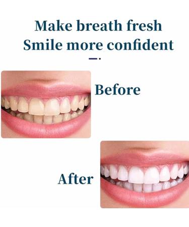 Body Accel Whitening Toothpaste Trio - Dazzling White Niacinamide Formula to Remove and Lighten Stains (3 PCs) - International Shipping Available - Buy Online on GoSupps.com