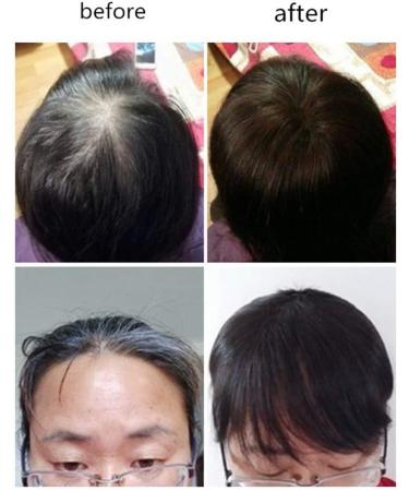 Real Human Hair Clip in Toppers with Bangs Women's Crown Hairpieces Wiglet for Thinning Hair (12" Dark Brown) - Buy Online on GoSupps.com