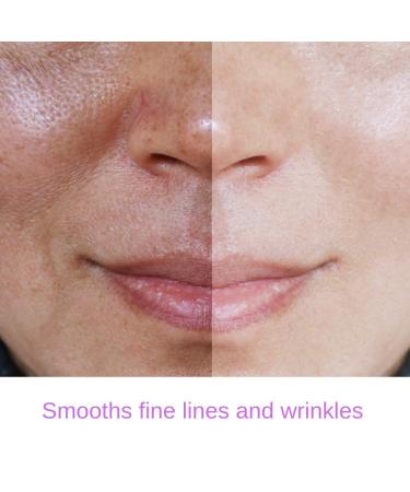 Buy RETINOL Serum 2.5% - Professional Anti-Aging with Hyaluronic Acid & Vitamin E - Minimize Wrinkles | International Shipping - Buy Online on GoSupps.com