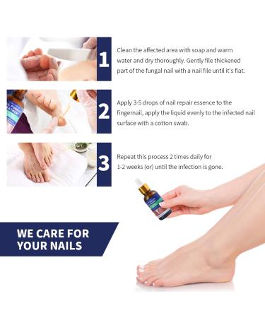 Nail Fungus Treatment - Toenail Fungus Repair Solution - Use at Home (1 Fl Oz) - Buy Online on GoSupps.com