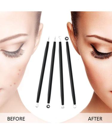 HOTX Pimple Popper Tool Kit - 4Pcs Set for Nose and Face - Blackhead Remover and Acne Needle Beauty Tool (Black) - Buy Online on GoSupps.com