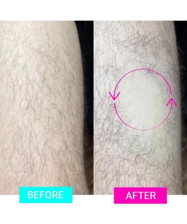 Xaydi Crystal Hair Eraser: Pain-Free Hair Removal Epilator Device - Women's Men's Razor Alternative - Gold - Buy Online on GoSupps.com