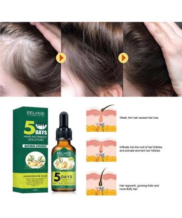 dijiusidy Ginger Hair Growth Oil Prevent Baldness Good-absorption Fast Growing 30MLSerum Nourish Tools Female - Buy Online on GoSupps.com