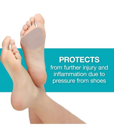 Steins Metatarsal & Heel Moleskin Foot Pads - 100 Count Tan | Bunion, Callus & Blister Protection, Alleviates Shoe Friction - Buy Online on GoSupps.com