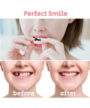 LEOONER 2 Pairs Temporarily Adjustable for Men and Women Nature and Comfortable Regain Confidence Smile - Buy Online on GoSupps.com