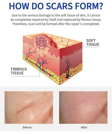 Shark Scar Repair Water 30ml - Moisturizing Scar Removal Liquid for Skin Repair | Color One Size - Buy Online on GoSupps.com