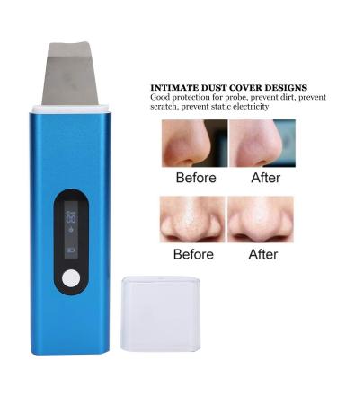 Skin Scrubber Face Spatula - Blackhead Remover & Pore Cleaner for Deep Facial Cleansing | Shop Internationally - Buy Online on GoSupps.com