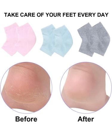 Vented Moisturizing Gel Heel Socks 3 Pairs - Toeless Spa Socks for Foot Care Treatment - Cracked Heels, Dry Feet, Foot Calluses - Gray, Green, Pink - Buy Online on GoSupps.com