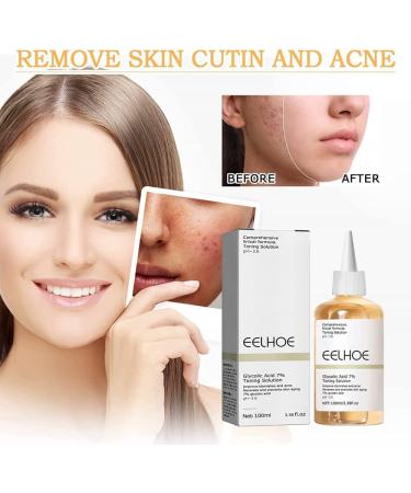 Glycolic Acid 7% Toning Resurfacing Solution -Glycolic Acid 7% Toning Resurfacing Solution for Blemishes and Acne Anti-Aging Freckle Removal Acne Tighten Pores 3bottles - Buy Online on GoSupps.com