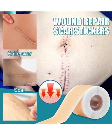 Silicone Scar Tape Roll - Self-Adhesive Patch for Acne Scars and Skin Repair (3pcs) - Buy Online on GoSupps.com