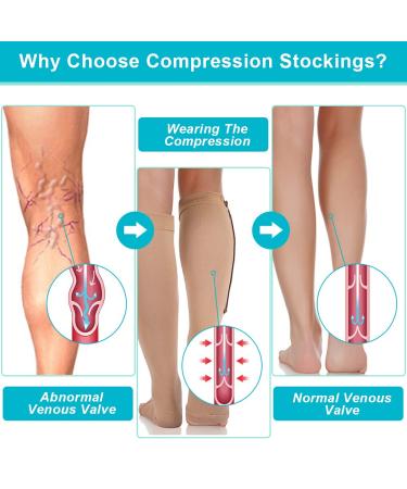 Shop Compression Stockings for Men & Women | Toe-Free Calf Zip Compression | Medical Grade Support (L/XL Skin) - Buy Online on GoSupps.com