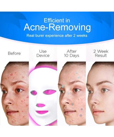 Led Light Therapy Photon Mask Acne Treatment 7 Color Home Use Skin Rejuvenation Anti-Aging Acne Spot Scar Removal Smooth Wrinkles Fine Lines Skin Tightening Facial Beauty Daily Skin Care - Buy Online on GoSupps.com