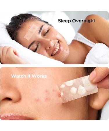 XFSRG 302 large patches of pimples with tea tree oil of salicylic acid and niacinamide for large pimples on chin cheeks back Transparent1 - Buy Online on GoSupps.com