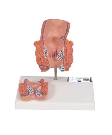 3B Scientific K27 Hemorrhoid Model - 3B Smart Anatomy