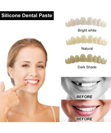 Shop High-Quality Cosmetic Teeth Veneers | Provisional & Immediate Dentures for Perfect Smile - Buy Online on GoSupps.com