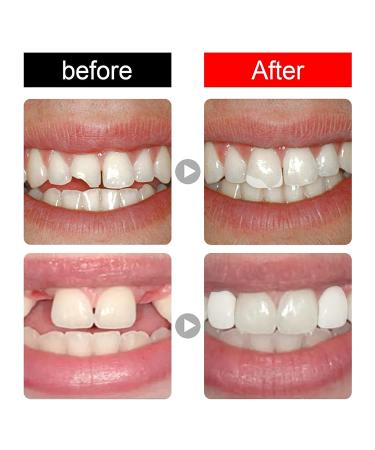 168 Pieces Complete Acrylic Resin False Teeth Denture Set - 6 Sets in A3 Shade for DIY or Halloween Costumes - Buy Online on GoSupps.com