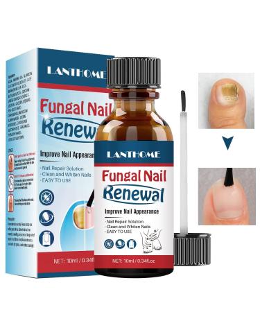 Nail Repair Essnce Liquid, Fingernail and Toenail Repair, Fix & Renew Damaged, Broken, Cracked & Discolored Nails, Reduce Nail Thickening, Strengthen Nails for Beautiful Nail