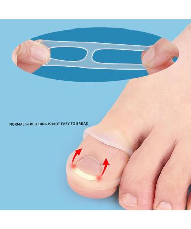 10 Pcs Toe Nail Corrector Ring Stretch Resistant Silicone Brace for Ingrown Toenails Transparent Reusable Design - Buy Online on GoSupps.com
