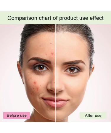 Glycolic Acid 7% Toning Solution Glycolic Acid Toner Glycolic Acid 7% Toning Resurfacing Solution Moisturize & Strengthen Skin Exfoliating Glycolic Acid 7% Toning Solution 240 ml - Buy Online on GoSupps.com