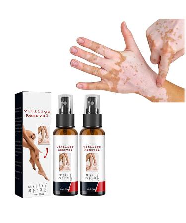 DUBUSH Vitiligo Kalmerende Spray Vitiligo Skin Repair Spray