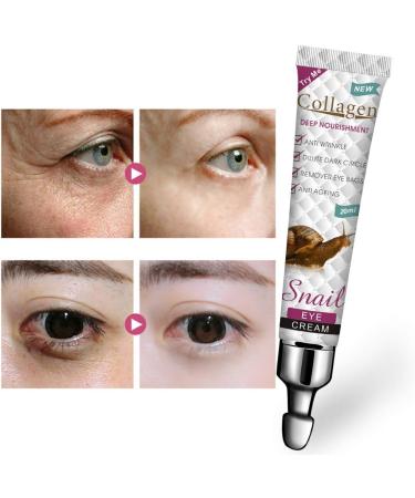 Snail Eye Cream Anti Aging Under Eye Cream For Dark Circles And Puffy Eyes Skincare Remove Eye Bag Fade Fine Line Crow'S Feet Firm Lift That Delicate Skin Under Your Eyes - Buy Online on GoSupps.com