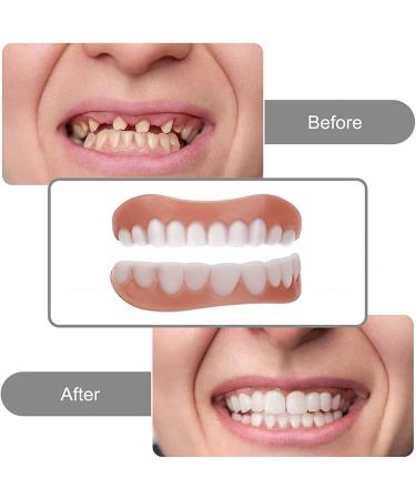 Mxrfactory Dentures Pebble Gel Smile Veneer - Comfort Fit Flex Veneers for Perfect Smile - 12 Pairs for Men & Women - Buy Online on GoSupps.com
