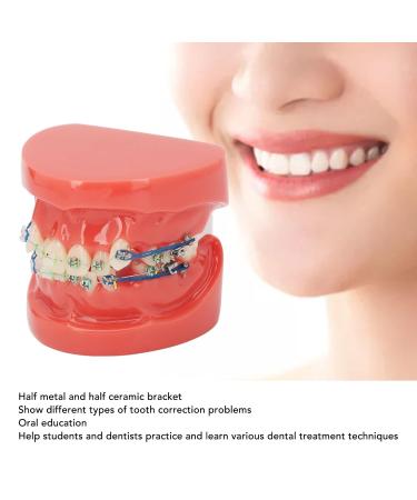 Buy GFRGFH Dental Model with 24 Teeth - Half Metal Half Ceramic Bracket for Teaching & Study - International Shipping Available - Buy Online on GoSupps.com