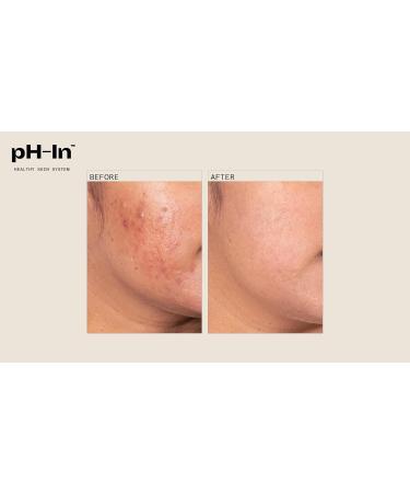 3 Step Healthy Skin System | Achieve Radiant Skin | International Shipping Available - Buy Online on GoSupps.com