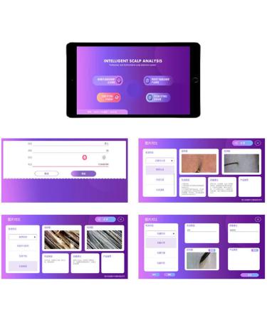 Skin Diagnosis Hair Analyzer 50 to 200X Magnification Clear Scalp Imaging Rechargeable Portable Design Auto Analysis and Suggestions for Healthier Hair - Buy Online on GoSupps.com
